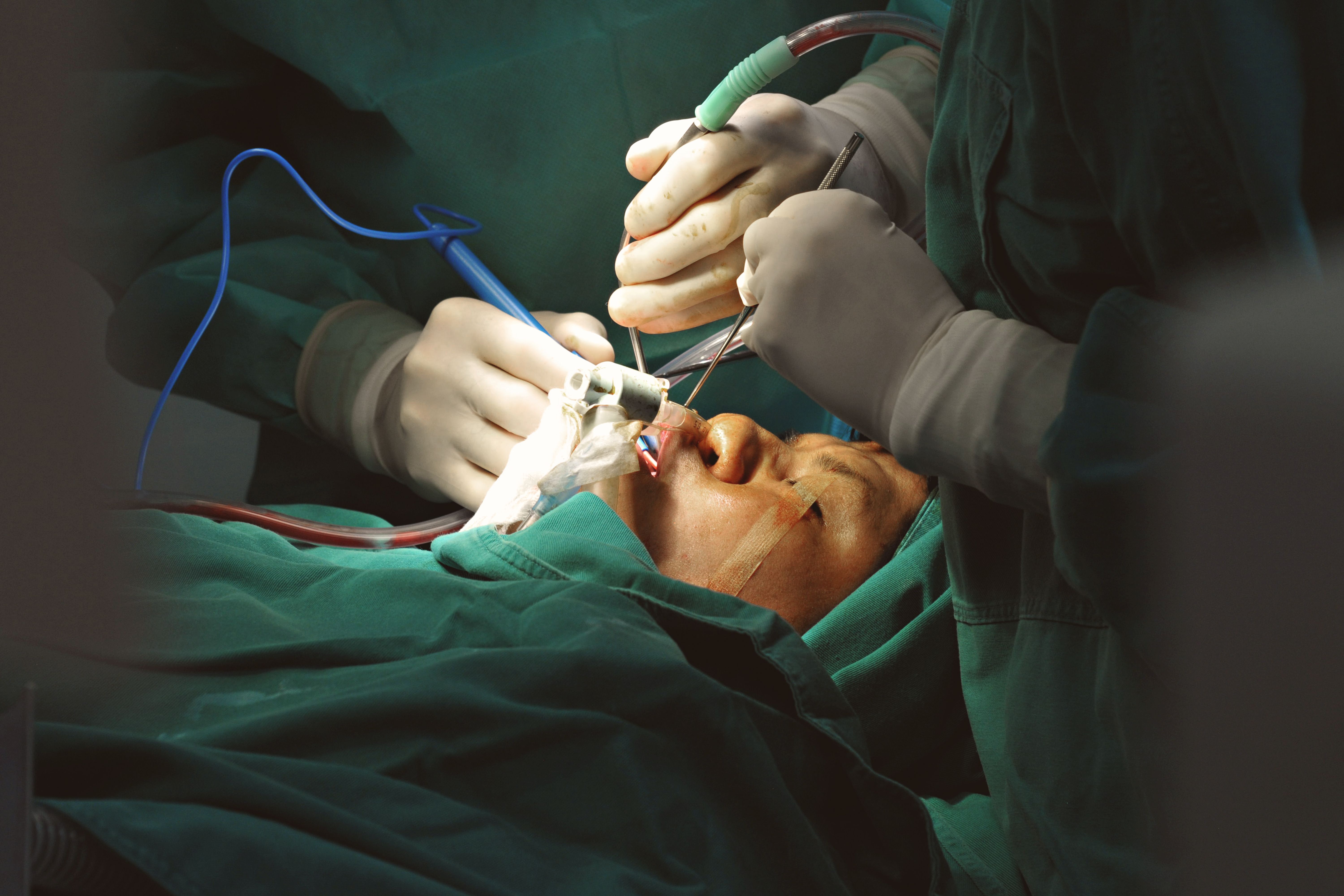 Rhinoplasty treatment result 3